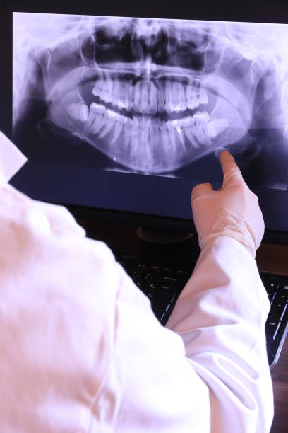 Best Emergency Tooth Extraction in Zeeland, MI
